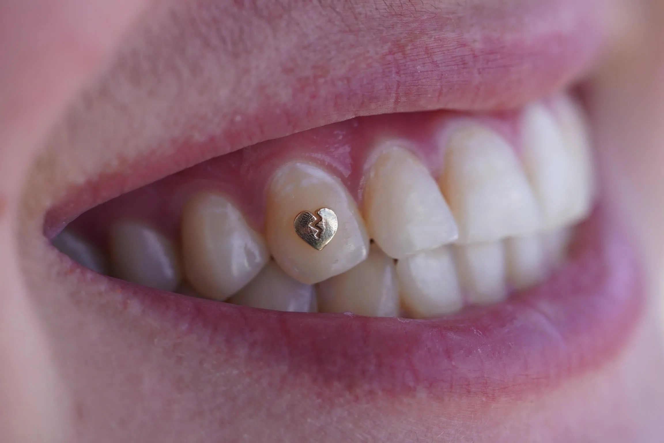 Broken Heart Tooth Jewelry